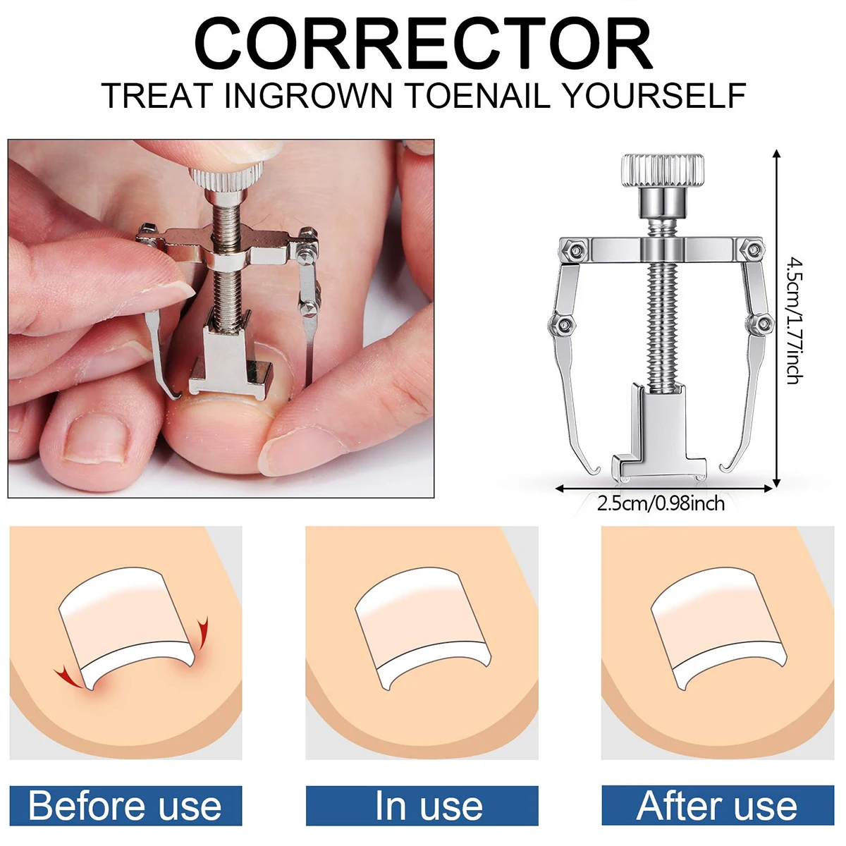 10Pcs Ingrown Toenail Clippers Kit Stainless Steel Ingrown Toenail Removal Kit Clippers Set for and Thick Nail