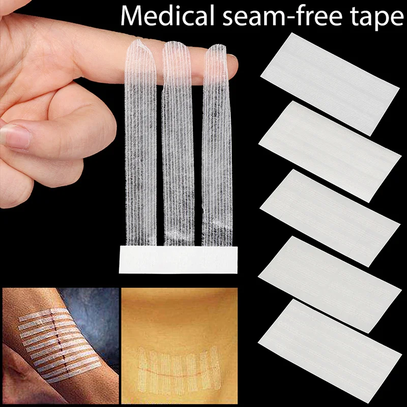 

4Bags Wound Skin Closure Strips Adhesive Medical Suture Free Surgical Tape Postpartum Wound Repair Cosmetic Surgery Steri-Strip