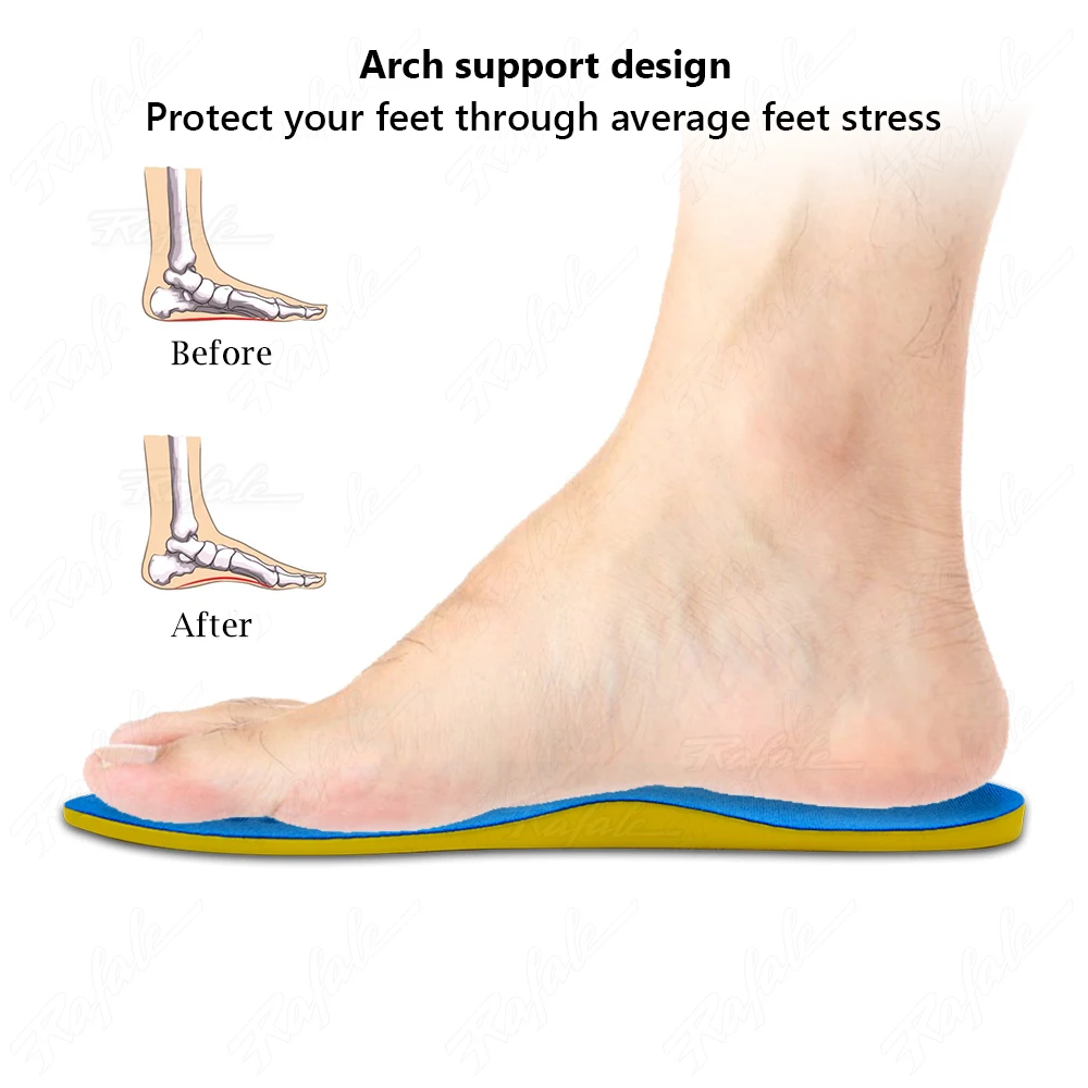 Orthopedic Insoles For Feet Corrective O Type Leg Insoles Inserts