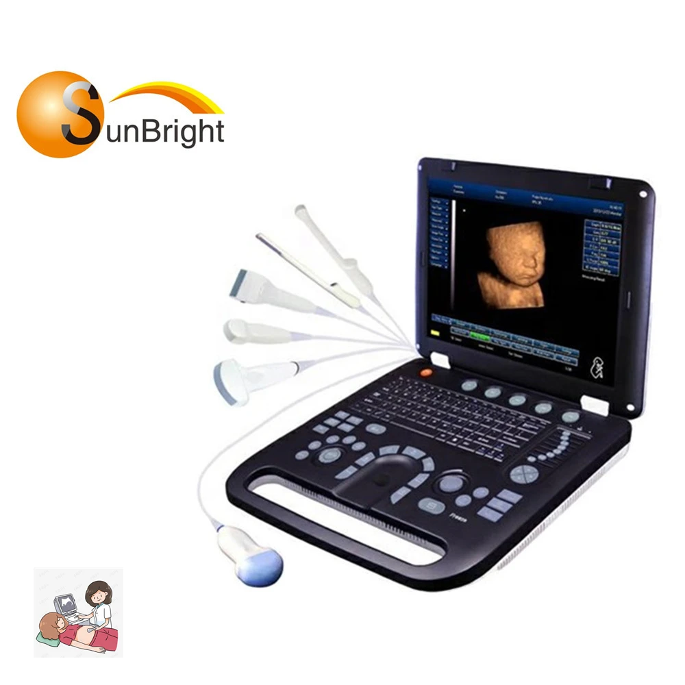 Ecografo Portatil En Color Doppler De Escaner Portatile Ultrasonido 4D Bajo Precio
