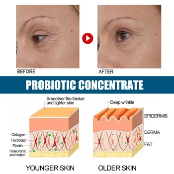 30ml V89 Probiotic Concentrate Anti-Wrinkle Serum Hyaluronic Acid Anti Aging Brightening Cream Facial Lifting Firming Daily - Thumbnail 5