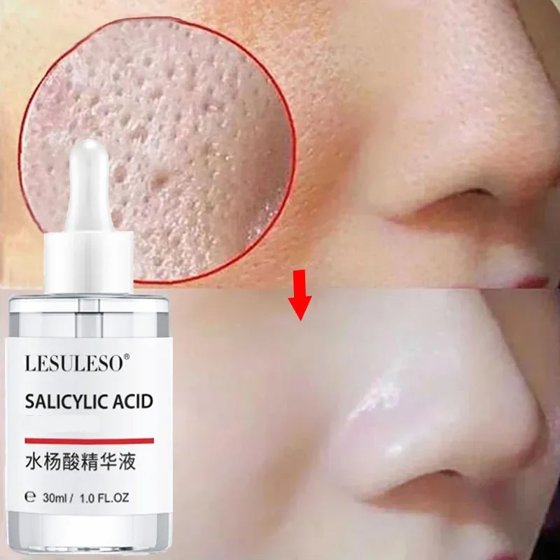 

Lactobionic Acid Pore Shrink Face Serum Effective Refine Pores Smooth Skin Moisturize Nourish Firm Care Essence Korean Cosmetics