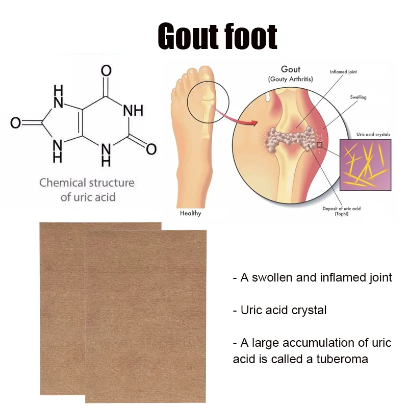 12PCS Gout Patch Rheumatoid Arthritis Sticker Uric Acid Nodule Relief Patches Knee Joint Pain Herbal Formulas Health Care