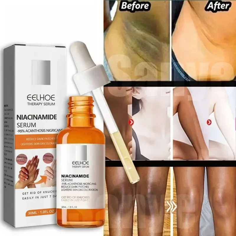 

Body Whitening Cream Lighten Dark Skin Intimate Areas Whiten Serum Armpit Knee Private Parts Brightening Essence Women Skin Care