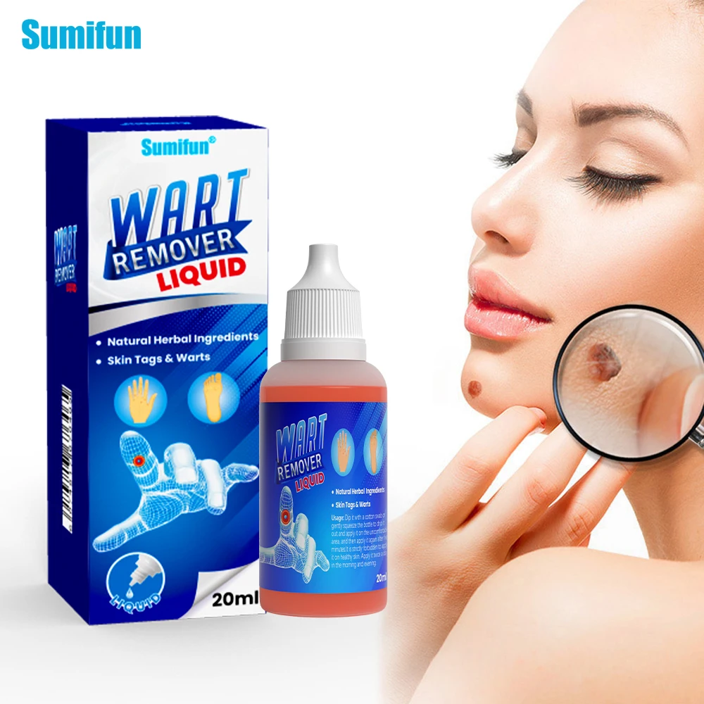 

1Box 20ml Sumifun Wart Remover Liquid Skin Tag Mole Removal Antibacterial Cream Remove Foot Corn Repair Massage Care Lotion