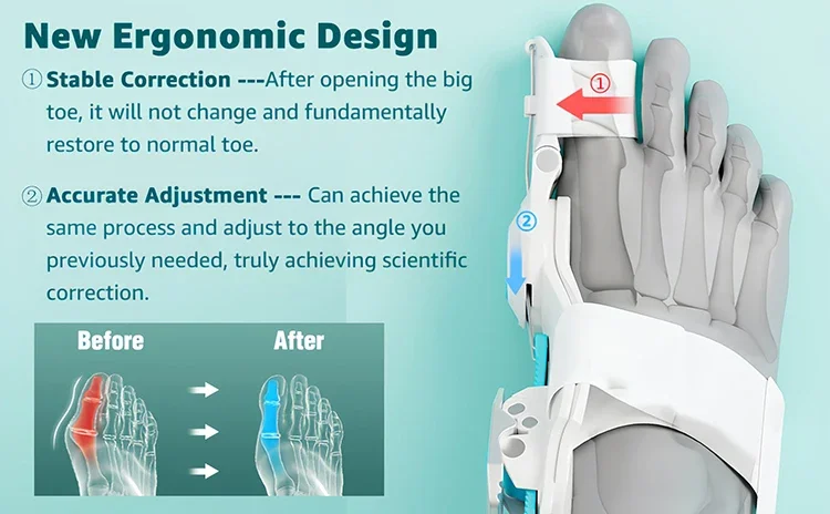 1Pc Bunion Corrector Orthopedic Big Toe Straightener Corrector Adjustable Hallux Valgus Brace Foot Care Bunion Relief