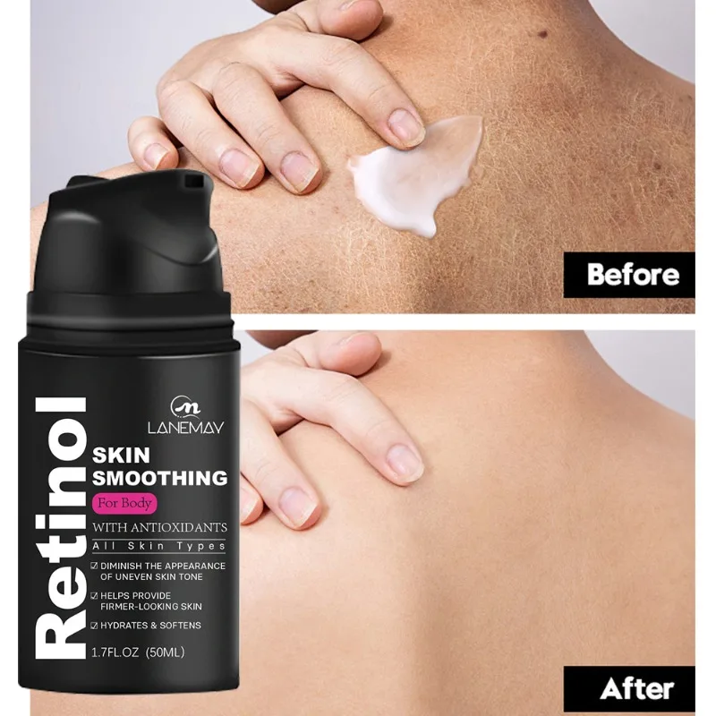 

Whitening Refreshing Moisturizing Emollient Softening Keratinizing Retinol Body Lotion Deep Cleansing Brighten Skin Protection