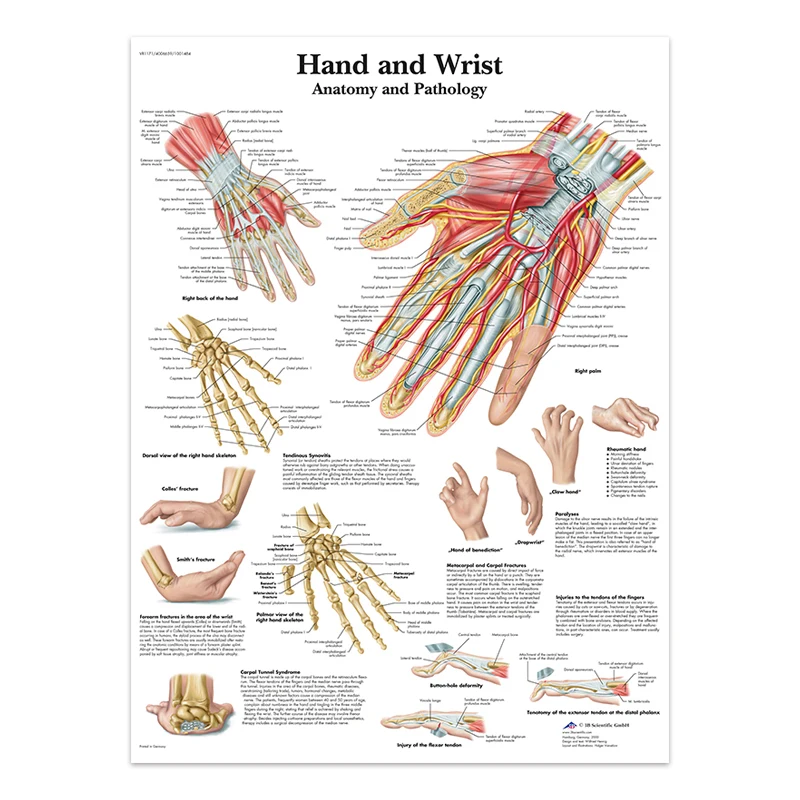 Body Structure Skeleton & Nervous System Anatomy Canvas Art - Educational Medical Decor Print
