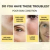 EELHOE Protein Line Can Lift Facial Skin Moisturize Repair Dry Make Look Younger Reduce Wrinkles Facial Essence Protein Line 4