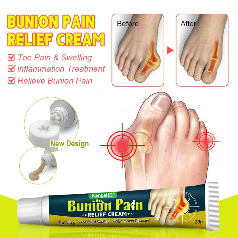 1Pcs Foot Gout Cream Arthritis Bone Thumb Corrector Finger Hallux Toe Bunion Joint Pain Relief Herbal Medical Care Ointment G049 knee pain relief cream pain relief cream skin care ointment