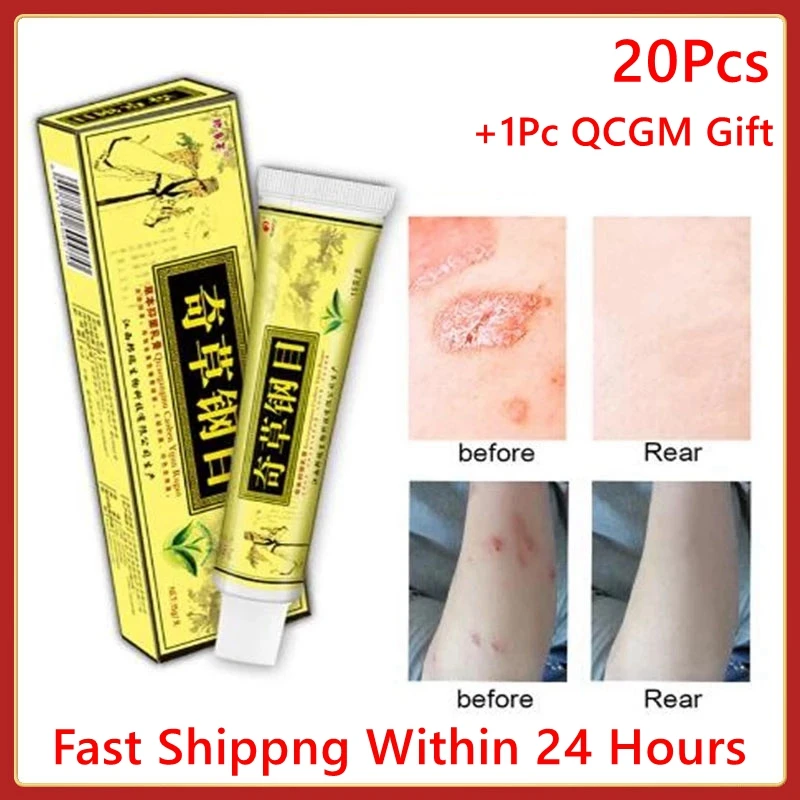 QICAOGANGMU 21 Pieces Skin Psoriasis Cream Treatment Ointment Dermatitis Eczematoid Health Drop Shipping |