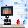 Wholesale Blood Capillary Nailfold Capillaroscopy Color Microcirculation Detector/Video Capillaroscope 6
