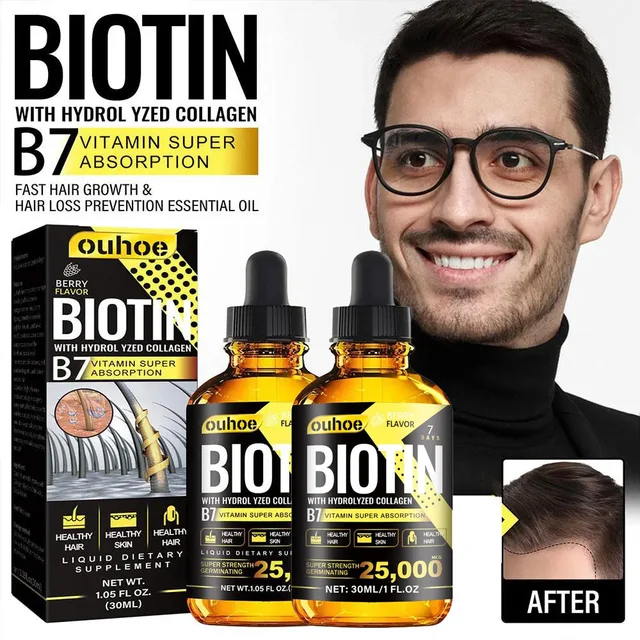 Huile essentielle de croissance des cheveux au collagène B7, vitamine, prévient la perte de cheveux et nourrit avec des huiles essentielles, ensemble de traitement du cuir chevelu pour hommes et femmes 1