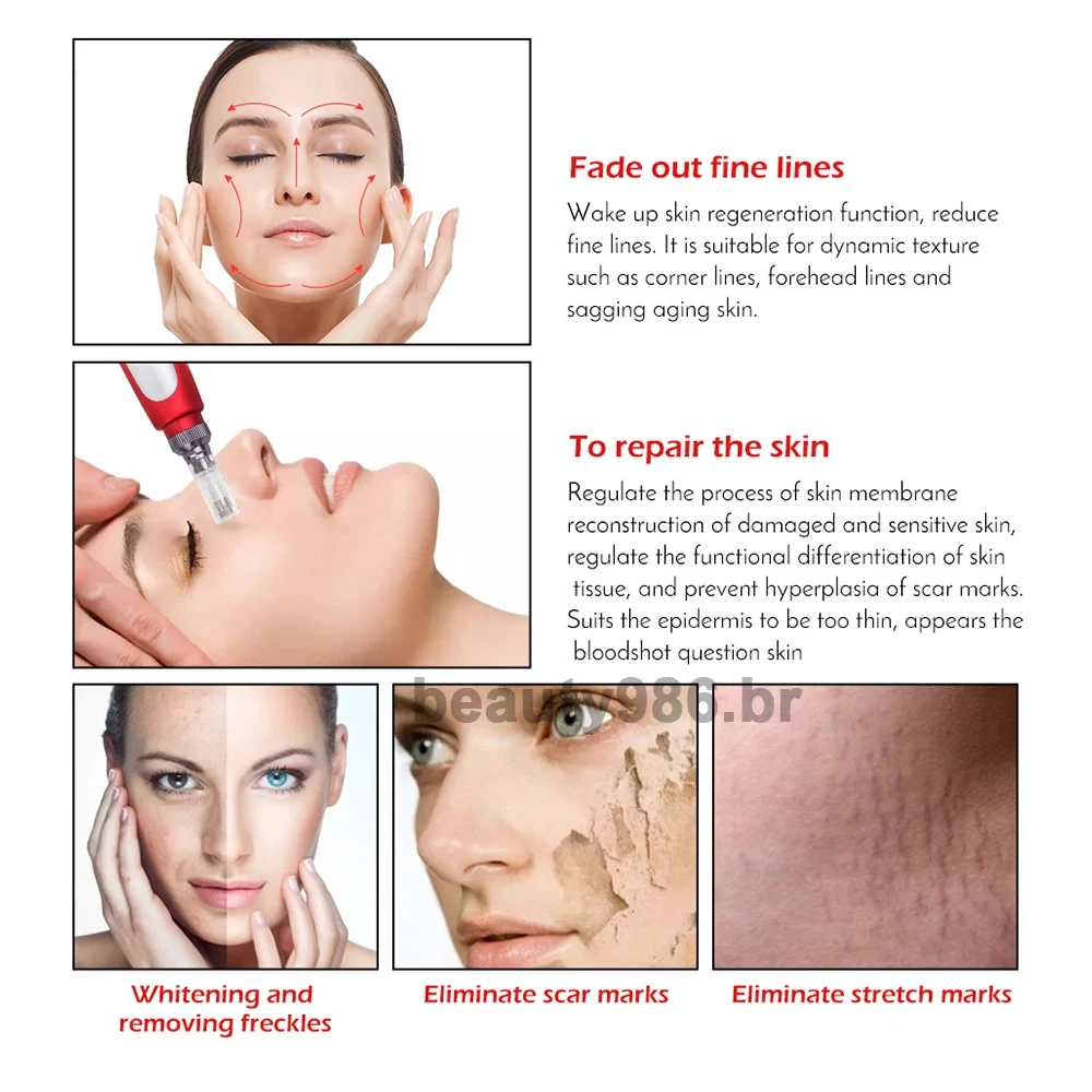 Рисунок 6 - Беспроводная профессиональная ручка MYM Microneedle