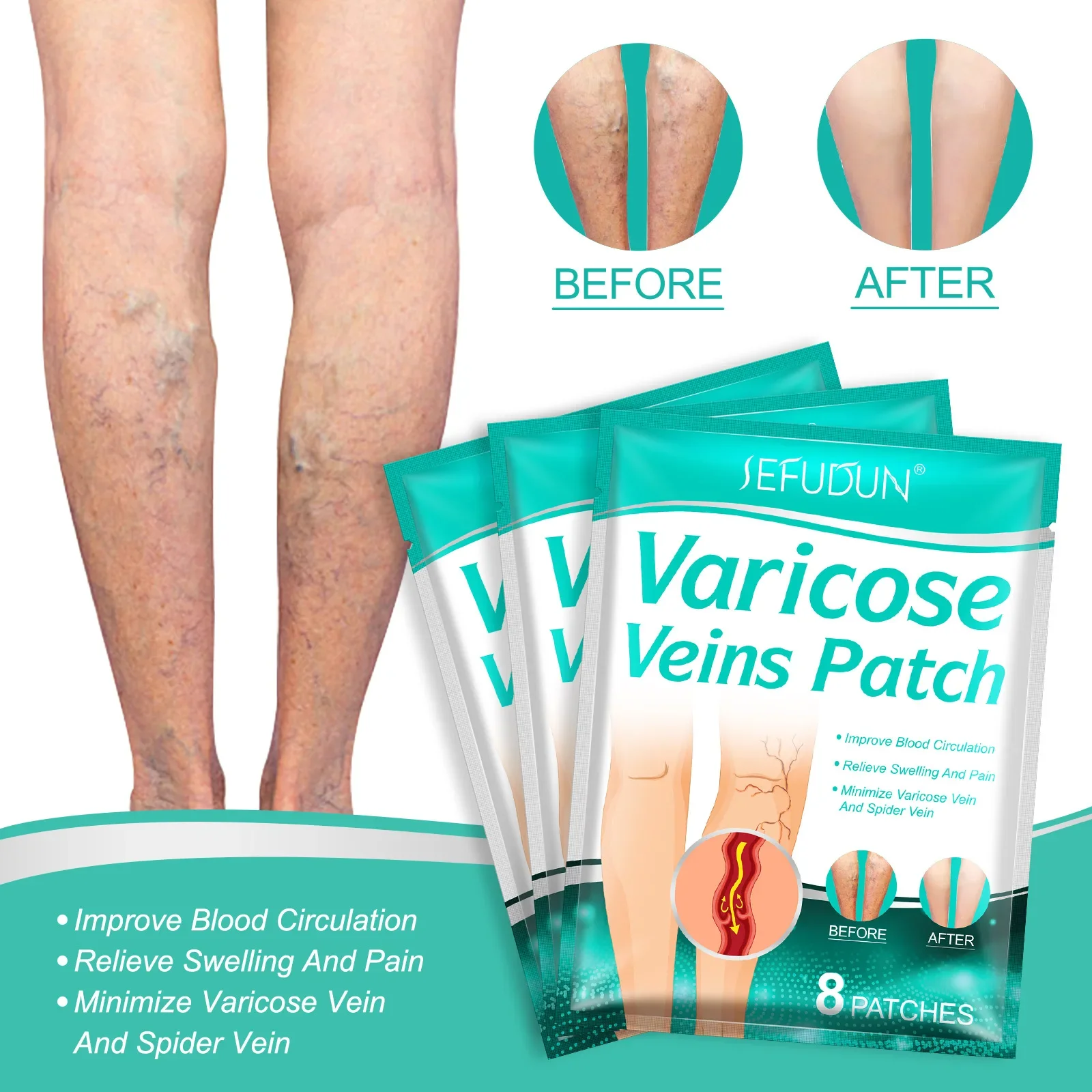 8 PCS Varicose Veins Patch Treatment For Varicose Veins Vasculitis Phlebitis Spider Leg Medical Patch Angiitis Removal