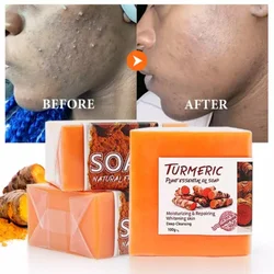 Turmeric Cleansing Soap, Handmade Ginger Essential Oil Bath, Anti-acne, Eliminate Pimples and Dark Spots