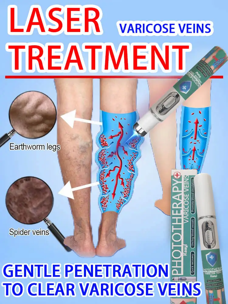 

Veines ᴅᴅᴅᴏᴏᴏᴏᴏᴇᴇᴇᴇᴇlaser laser s ᴅᴅᴅᴅᴅᴅᴅᴅᴀᴀᴀᴀᴀᴀᴀᴀᴀᴀᴀᴀᴀᴀᴀᴀᴏ ᴍᴍᴍᴍᴍᴍᴍᴍᴍᴍᴍᴍᴏᴏᴏᴏᴏᴏᴏᴏᴏᴏᴏᴏᴏᴏᴏᴏᴏᴏᴏᴏᴏᴏᴏᴏᴏᴏᴏᴏᴏᴏᴏᴏᴏᴏᴏᴇ