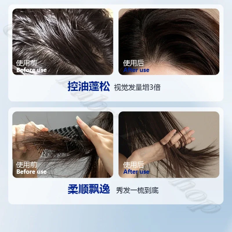 440ML large capacity selenium disulfide antipruritic shampoo oil fluffy to improve the scalp environment 5