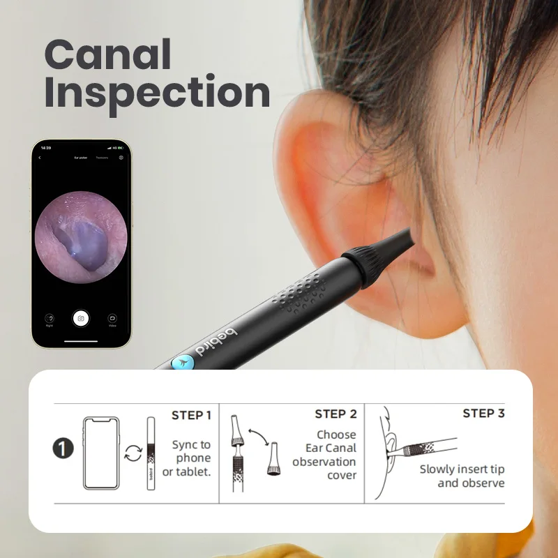 2024 Bebird ENT Observation Kit Set (Not Include Camera Device） 5
