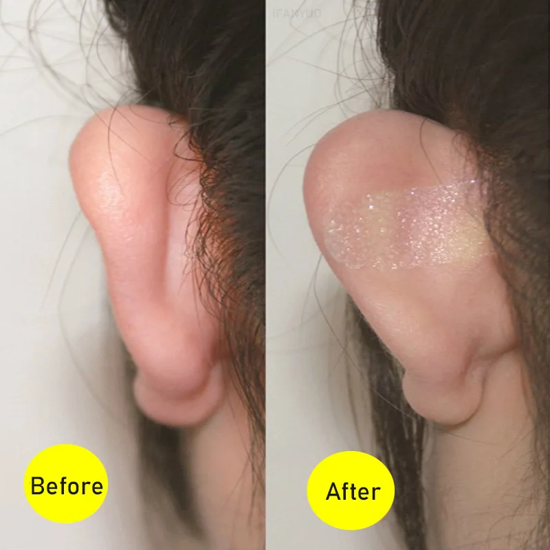 Elf Ear Stickers Veneer Ears Become Ear Correction Ear Stand Sticker[ I0X8  