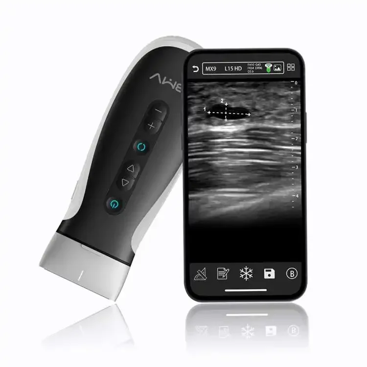 

3 In 1 Double Head Wireless Wifi Ultrasound Scanner Color Doppler, Cardiac Convex Linear Probe Pocket Handheld Ultrasound