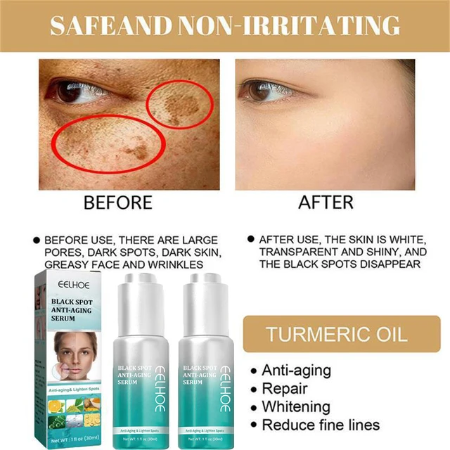 Kurkuma Fehérítő Szeplős Szérum Brighten Távolítsa El A Sötét Foltokat Melasma Megvilágít - Image 4