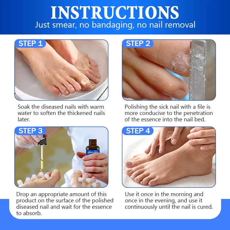 Jemeesen Fungus Removal Serum Gel Anti Infection Paronychia Onychomycos Nail Fungal Treatment Feet Care Essence Repair Nail Oil For Nail Fungus Remover