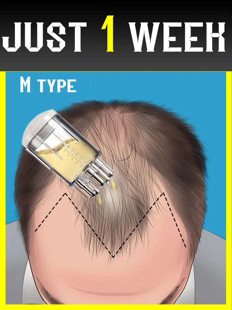 หวีนวดหนังศีรษะแบบมีที่จ่ายของเหลว ใช้งานง่าย พร้อมเซรั่มบำรุงผม 1