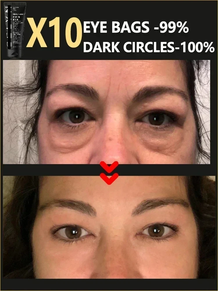 Eye Cream C&euml;lyn 3 Minutes Firm Lifting Tighten Alleviate Eye Bags Dark Circles Moisturize Peptide