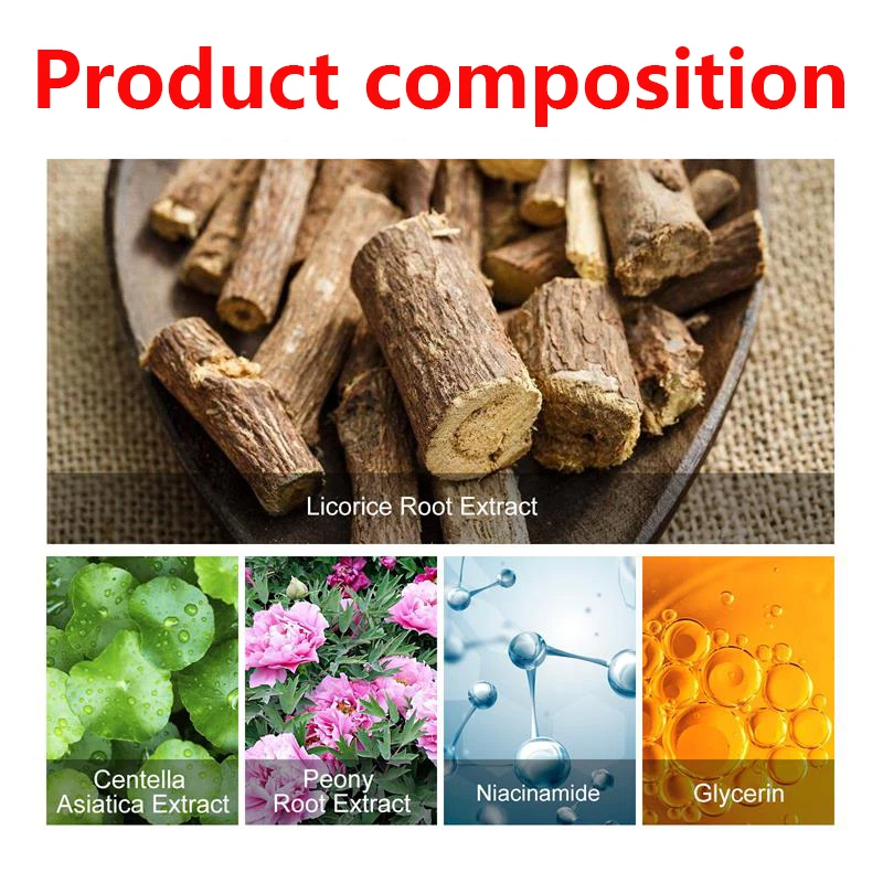 Facial Cream Freckle Whiten Cream Effective Removing Spot Eliminate Brown Stain Melasma Melanin Blemishes Lighten Moisturiser Face Skin Care