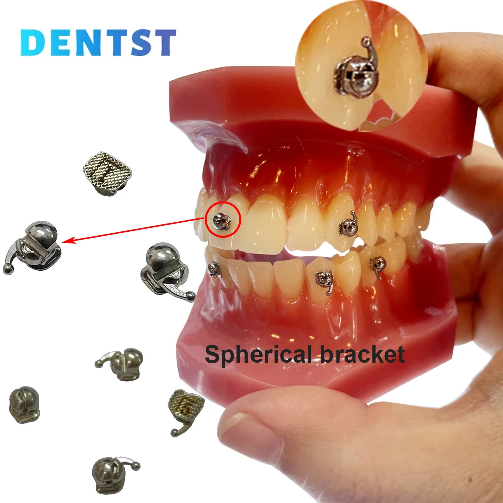 28PiecesDentalOrthodonticsSphericalBracket022MBTRothNon