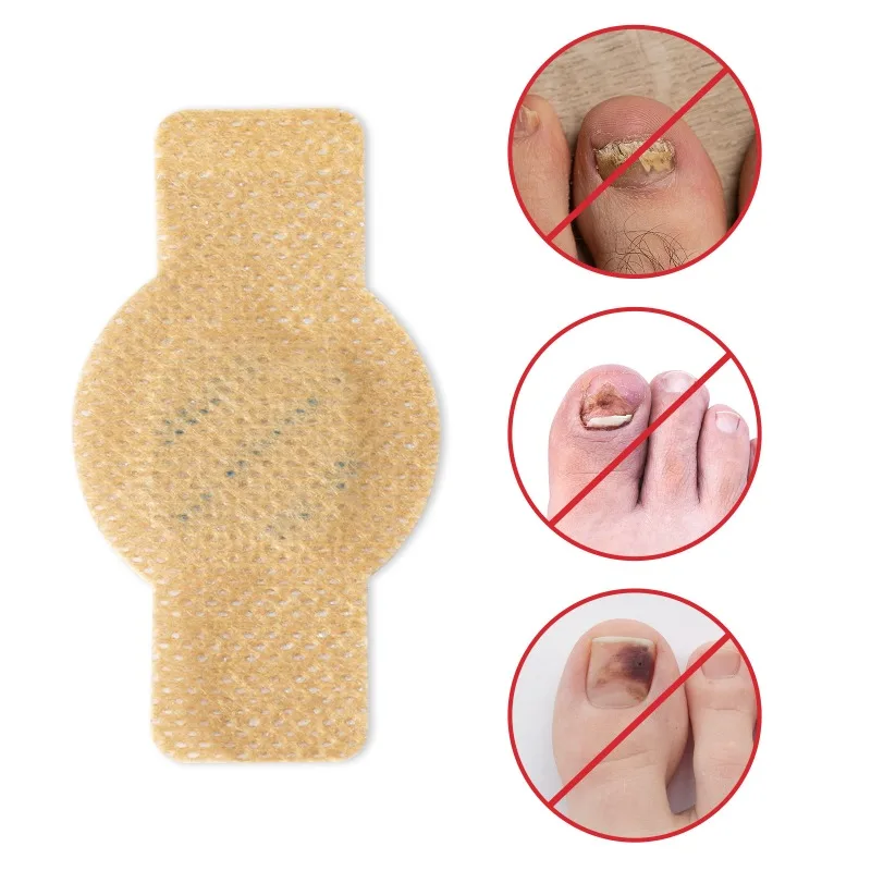 21/32Pcs Toenail Fungus Patch Nail Repair Patches Nail Ingrown Correction Sticker Discolored Damaged Nails Foot Care Tool