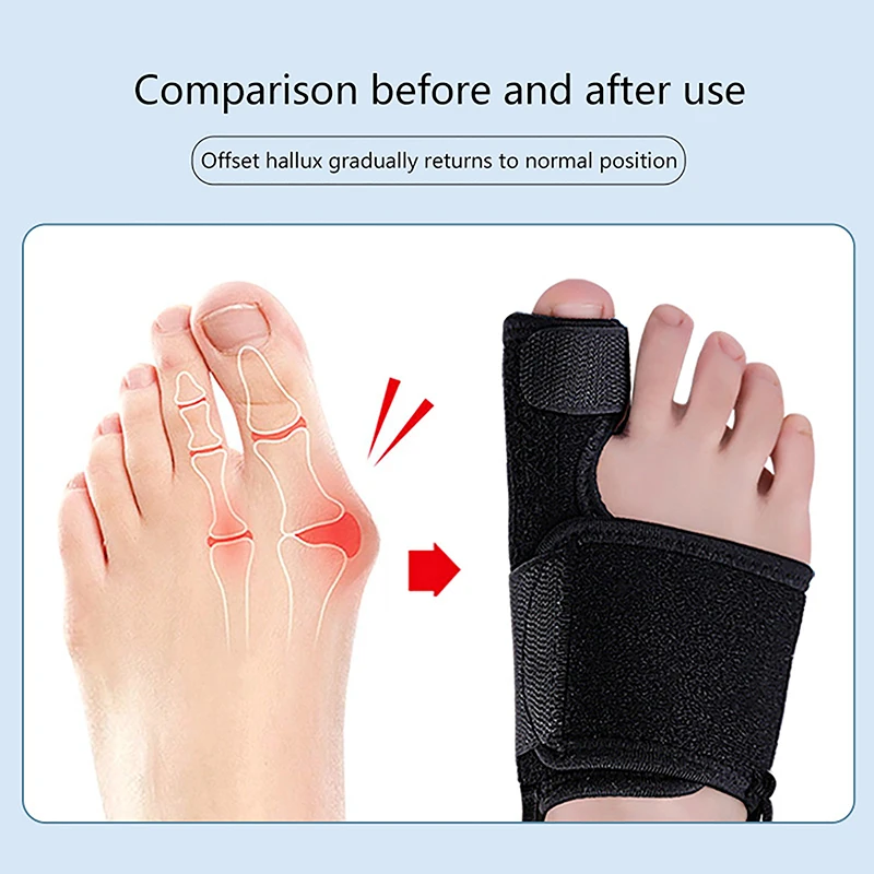 Toe Corrector 1PCS Toe Corrector Orthotics Bone Thumb Adjuster Hammer Protector Soft Pedicure Sock Bunion Straightener Foot Care Tools