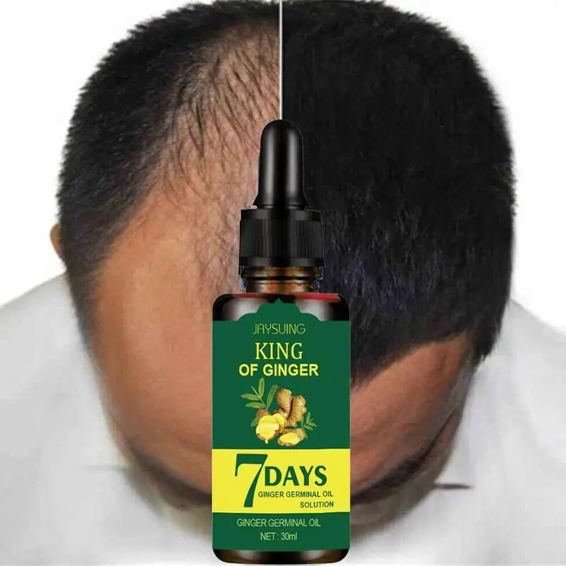 Ginger Essence Hair Loss Treatment Repair Nourish Hair Roots Scalp Care Essence Products For Men Women 30ml