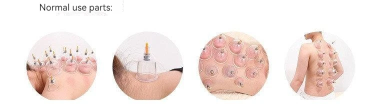 Description Picture 5 of itemVacuum Cupping Tools Chinese Medicine Stabbing Bloodletting Cupping Scraping Cupping Set Full Set Health Care Tool