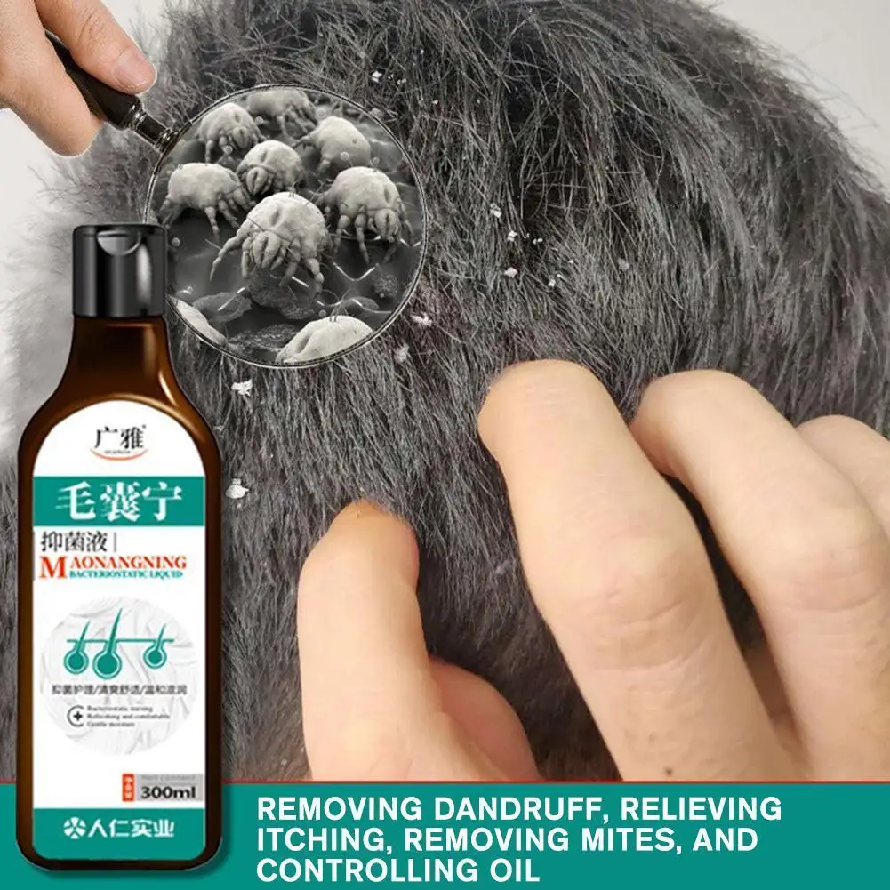 

Anti-Dandruff Anti-Itch Shampoo Chinese Herbal Hair Folliculitis Seborrheic Scalp шампунь dry Care Mite волос shampoo для P4T7