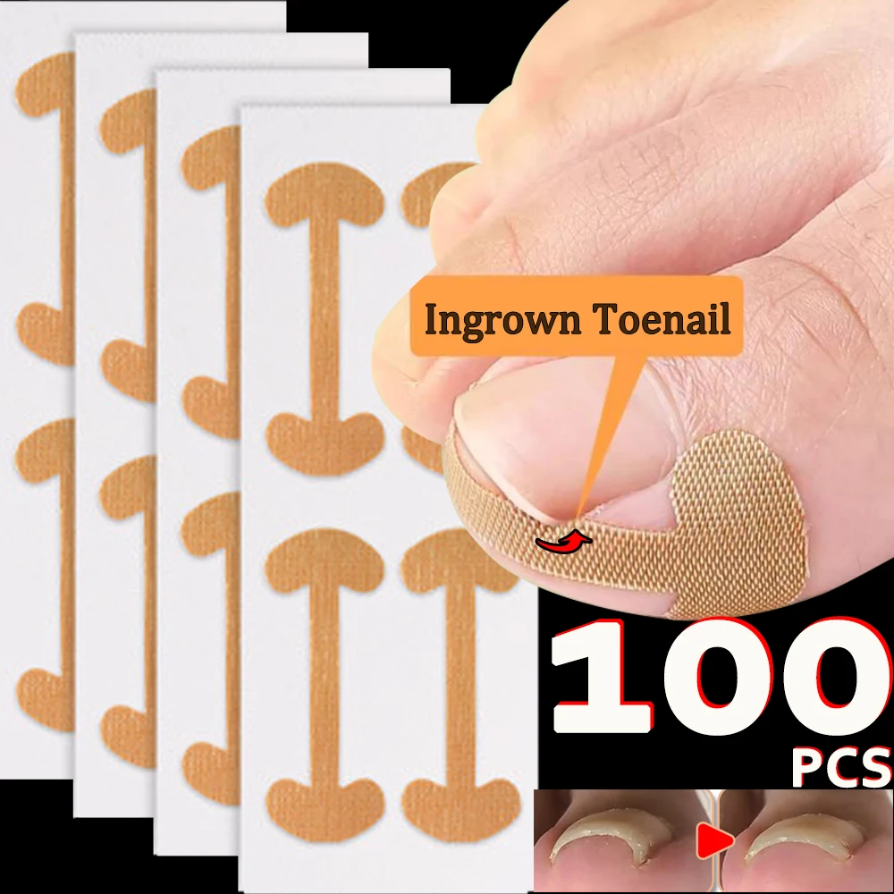 Nail Correction Stickers 100pcs Professional Painless Ingrown Toenail Correction Strips Waterproof Breathable Treatment Pedicure