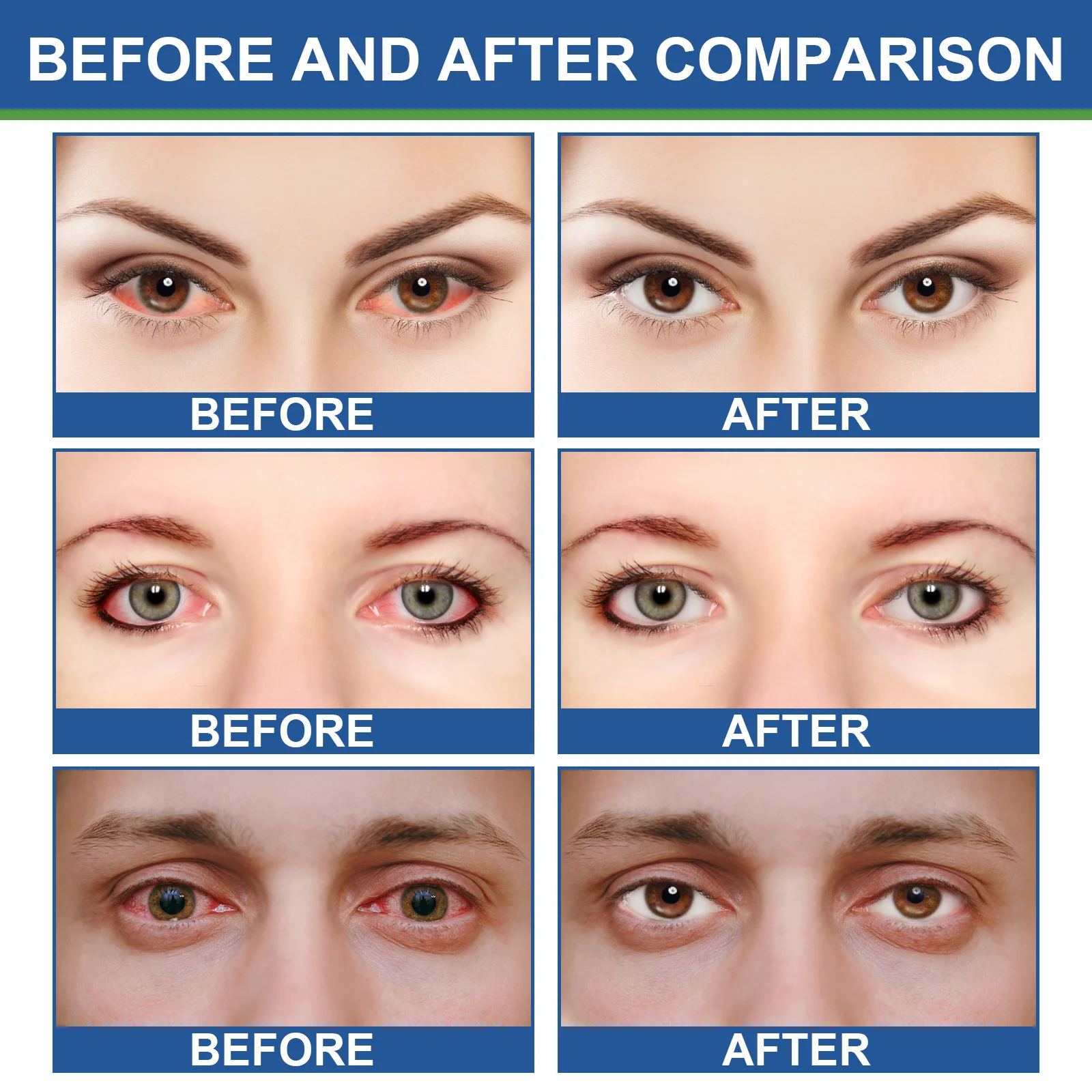 Details 147+ chinese cure for eye bags latest 3tdesign.edu.vn