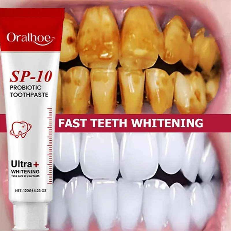 SP-10 Probiotic Toothpaste Remove Plaque Stains Whiten Tooth Fresh Breath Oral Hygiene Clean Teeth Care 120g
