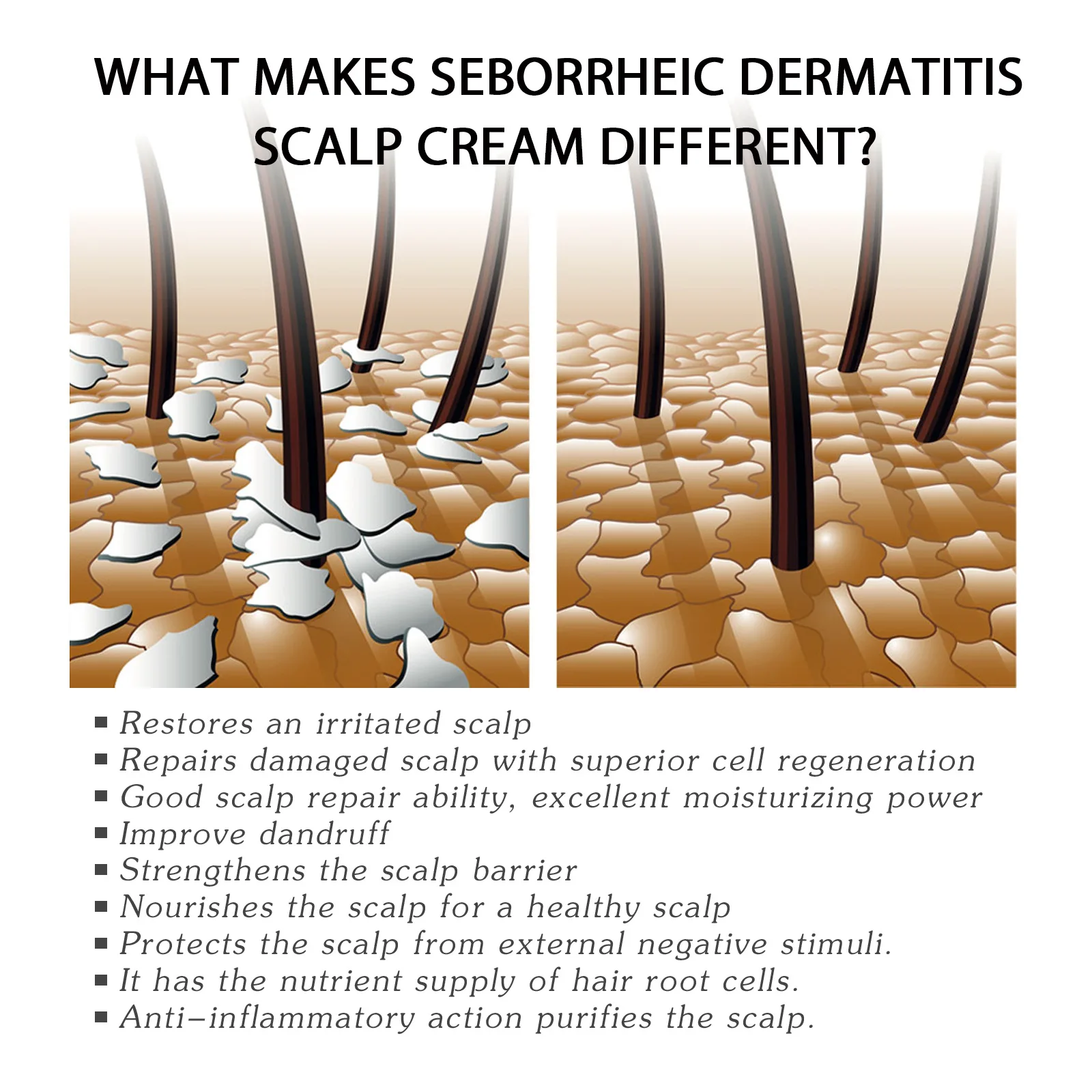 Seborrheic Dermatitis Cream Skin Care Treat Psoriasis Eczema Repair Scalp Relieve Itching Remove Dandruff Healthy Skin Ointment