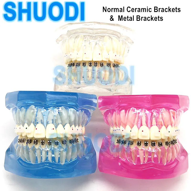 1000pcs Dental Orthodontic Ligature Ties Braces Elastic Rubber Bands 23 Color – La Paz County - Foto 4