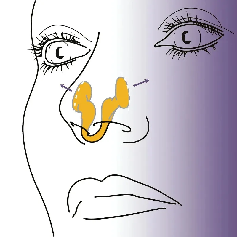 2pcs  Anti-Snoring Nose Vents-Silicone Nostril Dilator Stops Snoring Naturally, Breathable Nasal Clip for Better Sleep Breathing