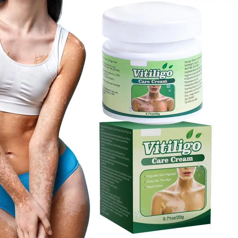 

20g Whitening Freckle Cream Remove Melasma Dark Spots Melanins Brighten Lightening Cream White Spot Remover