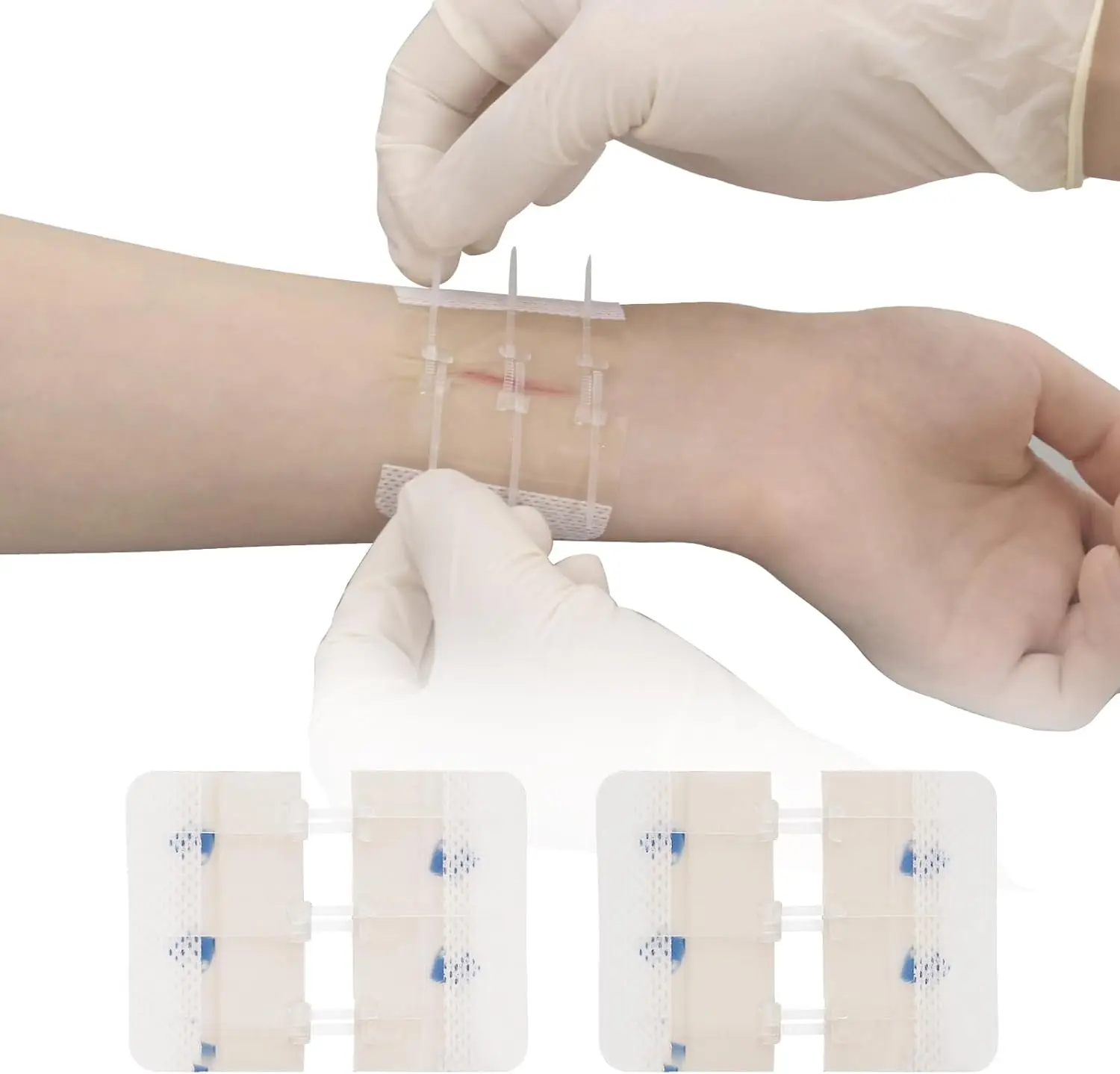 Zip Stitch Emergency Wound Closures Device Repair Wounds Without Stitches Zip Sutures Butterfly Bandaids Health Care