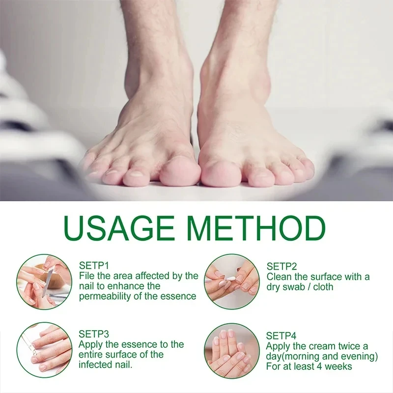 7 Day Nail Fungal Treatment Serum Foot Toe Nail Fungus Removal Essential Oil Anti Infection Onychomycosis Paronychia Repair Gel nail fungus remover