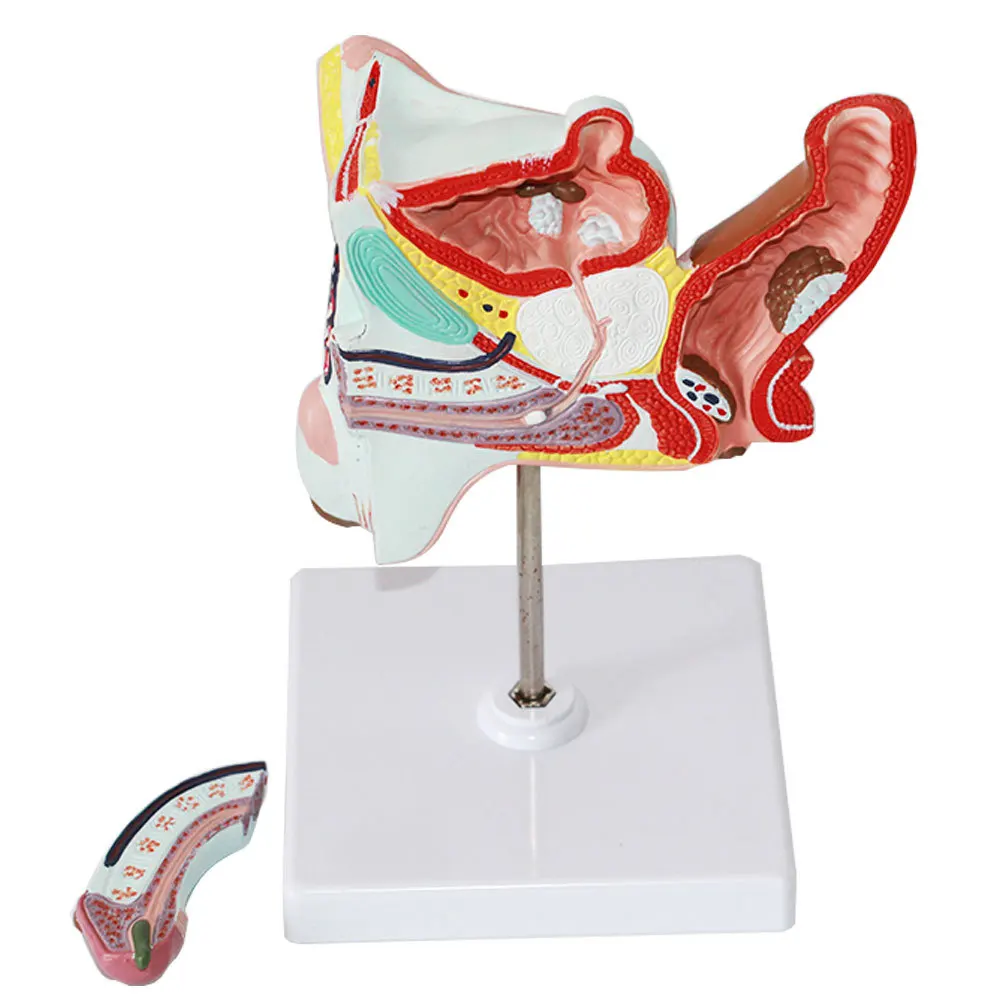 Male anatomical model of internal and external organs Male gonorrhea model Medical teaching equipment