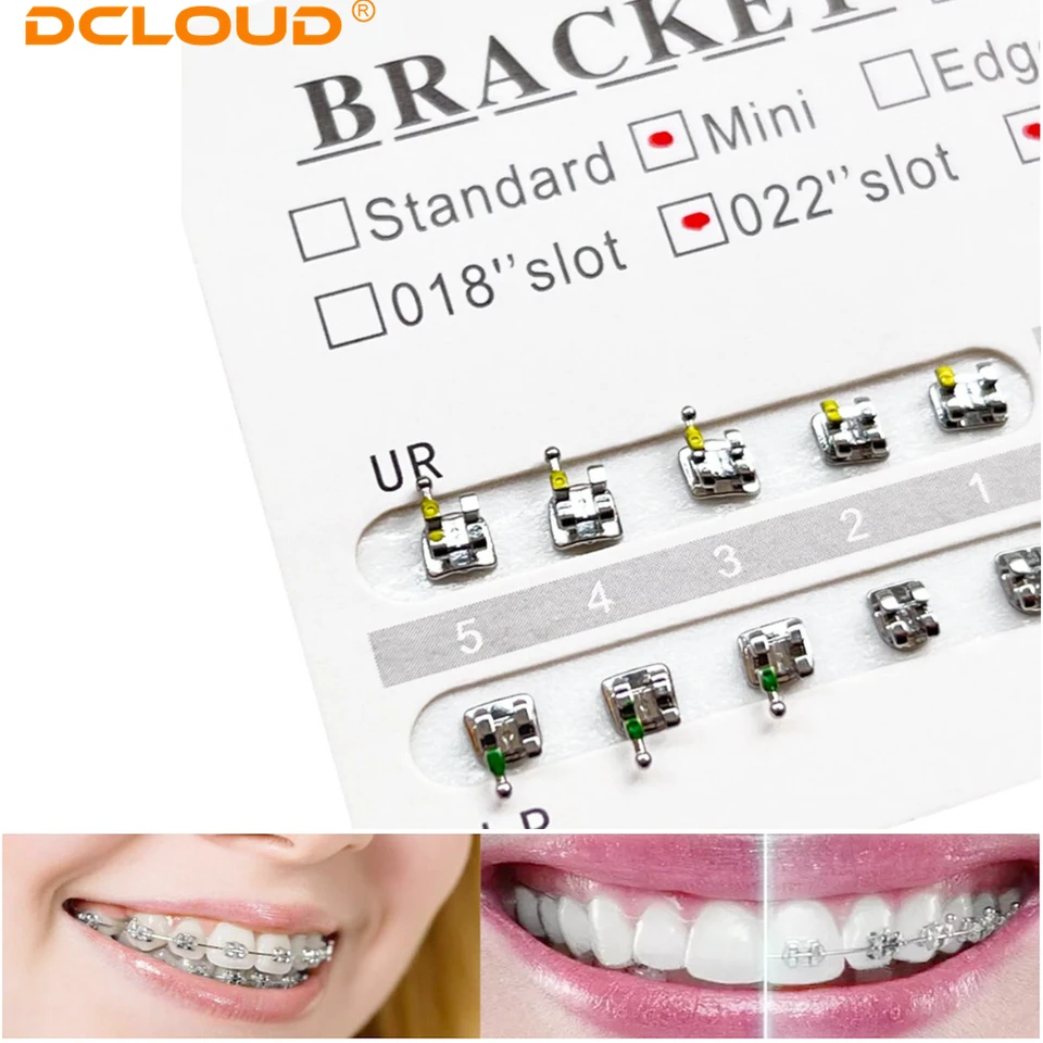 Mini Roth Brackets .022 10-Pack Dental – Mini Roth/MBT Style, 0.022