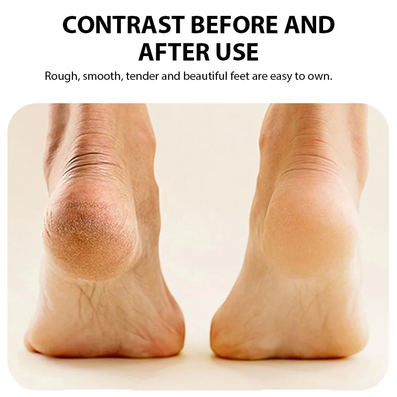 Home Electric Foot Remover for Dead Skin and Calluses Foot Care Repair Device for Exfoliation Removal Foot Skin Grinder Scrubber