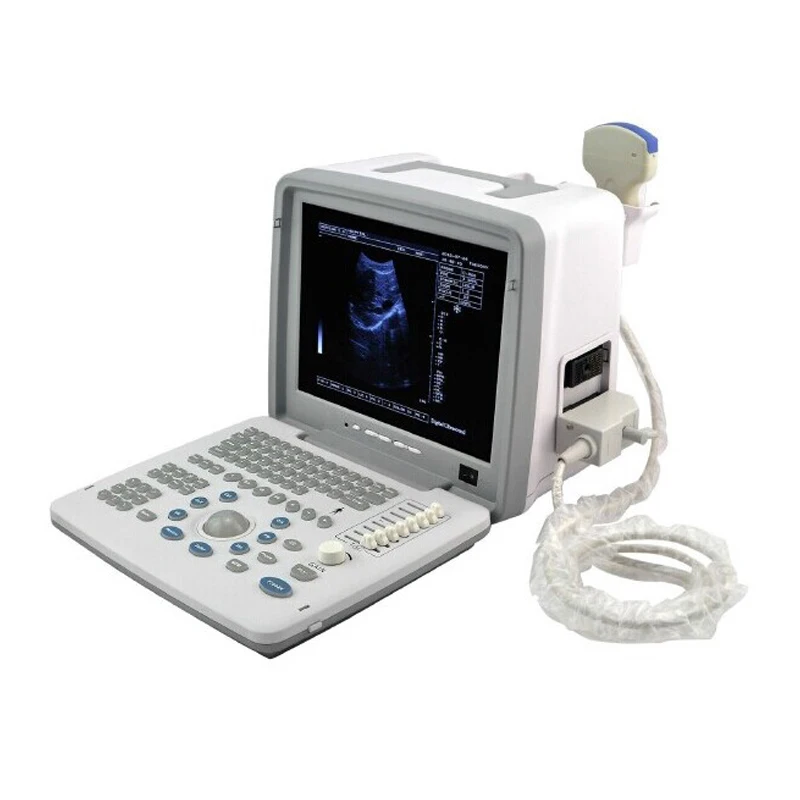 

Full Digital Portable Ultrasound Machine Manufacturer Best Price Medical B/W Ultrasound Scanner