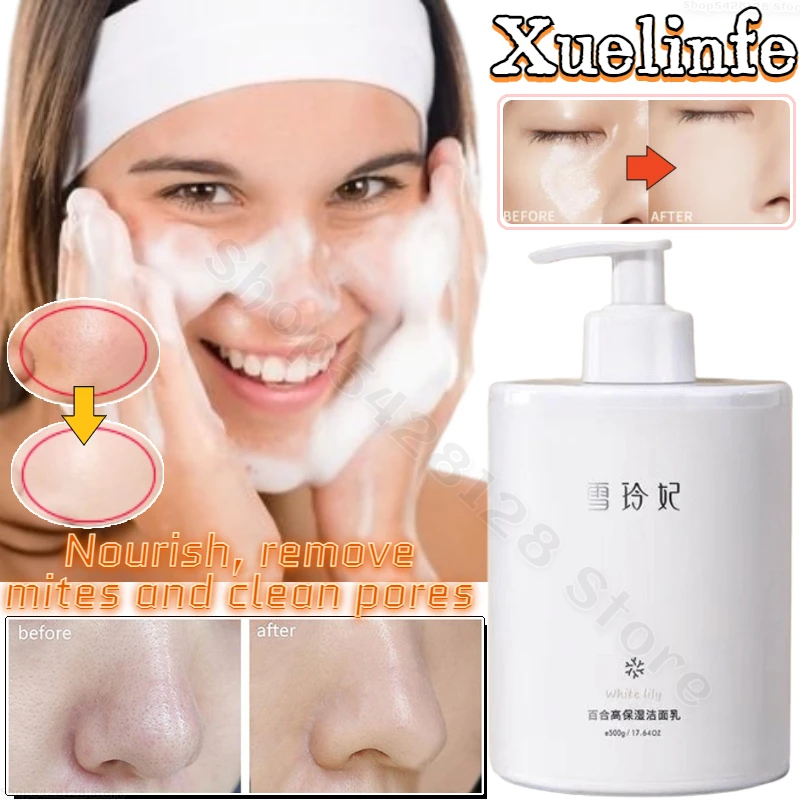 Xuelinfe Lily Amino Acid Cleanser Removes Mites Improves Skin Dullness Oil-controlling Cleanser Moisturizes and Does Not Tighten